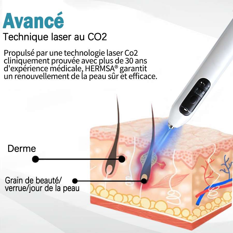 Hermsa® Stylo laser haut de gamme non invasif pour l'élimination des grains de beauté et des verrues