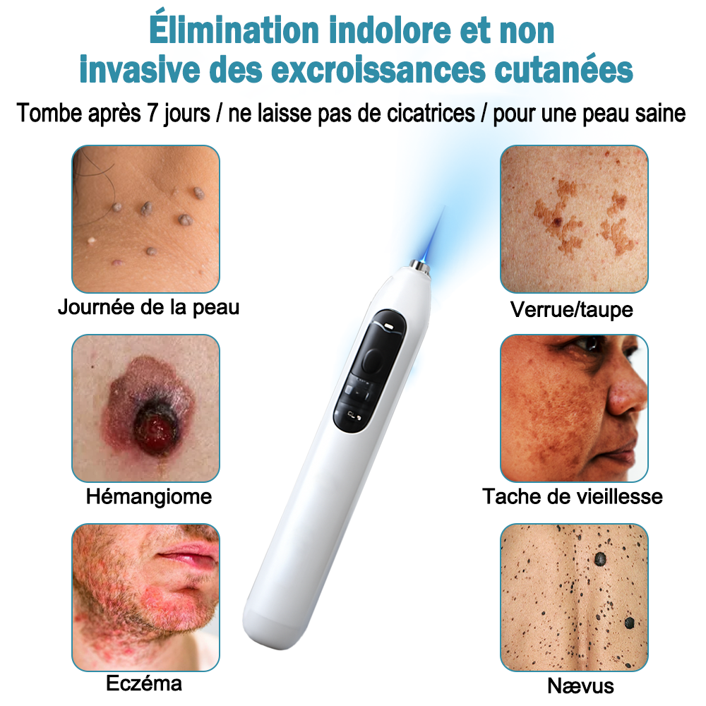 Hermsa® Stylo laser haut de gamme non invasif pour l'élimination des grains de beauté et des verrues